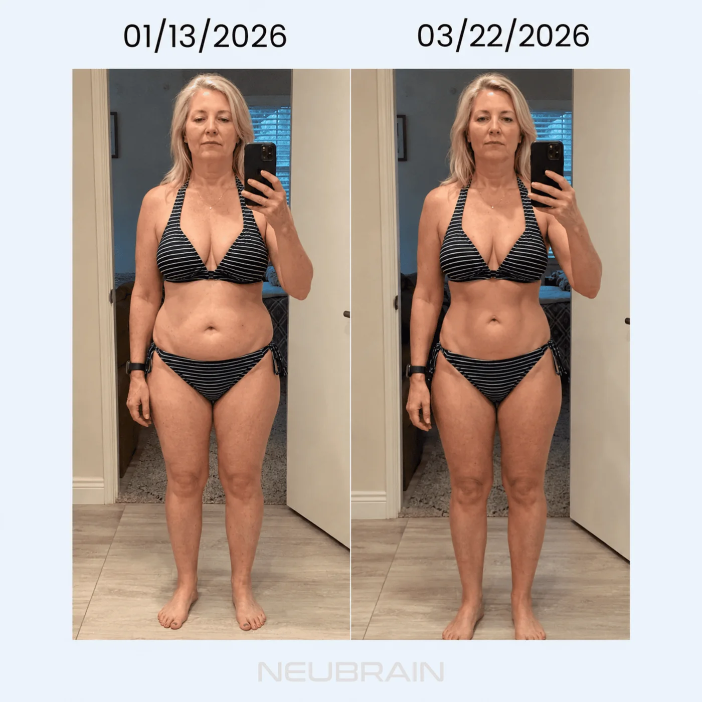Dated before-and-after from a NEUBRAIN customer